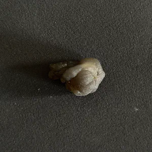 Botryoidal chalcedony